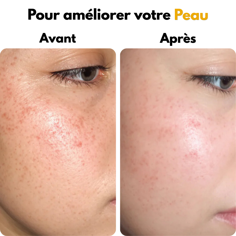Pods vitaminés